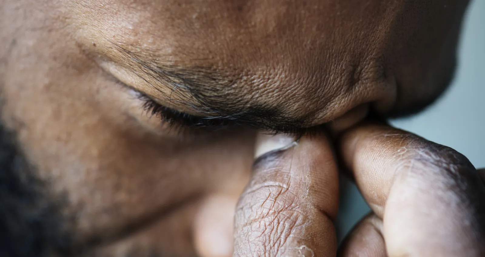 Foto de un hombre cogiendose los ojos, seña de que está estresado