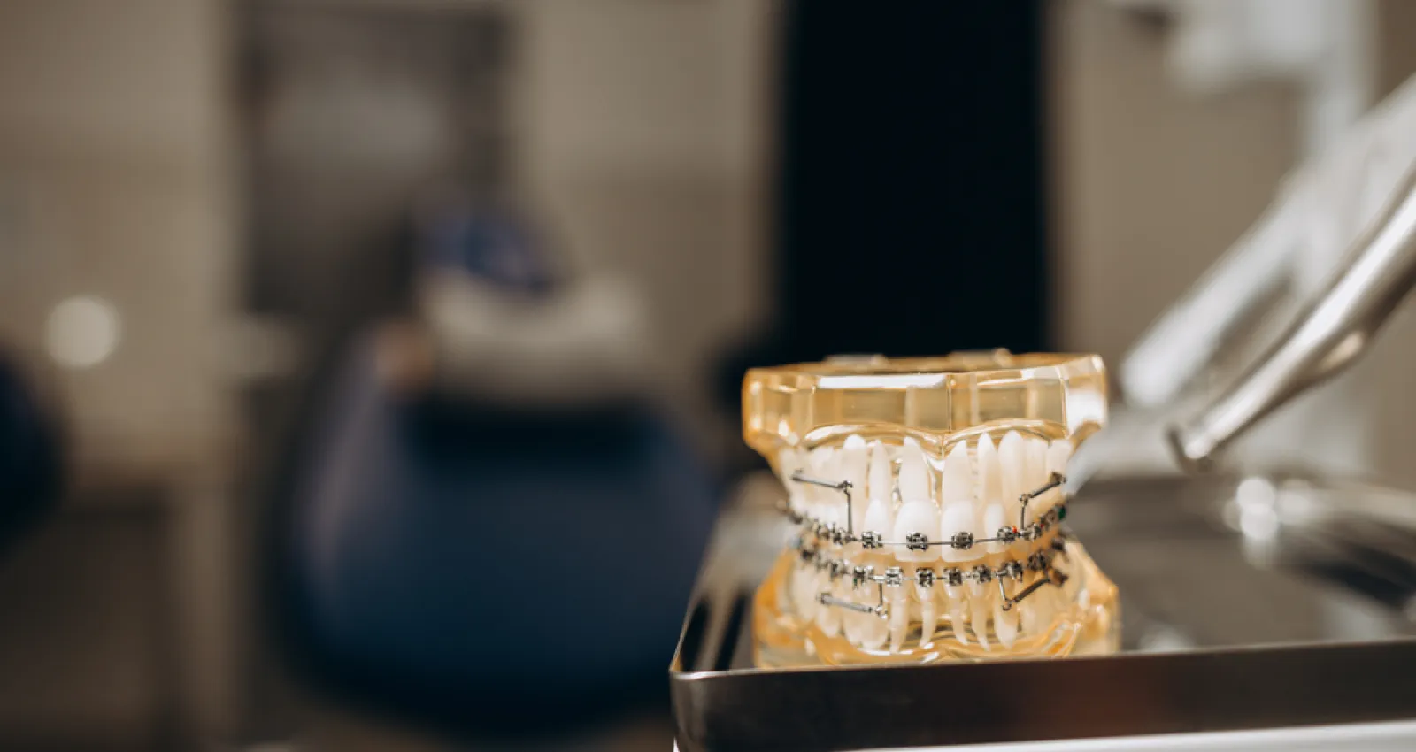 Foto de una protesis dental sobre una bandeja